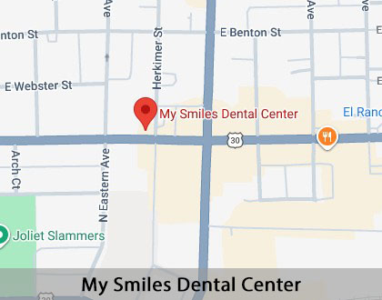 Map image for Wisdom Teeth Extraction in Joliet, IL